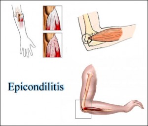 https://ergonomialpac.wordpress.com/